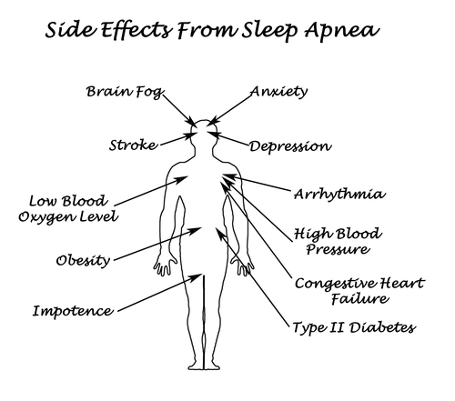 human body with sleep apnea symptoms shown
